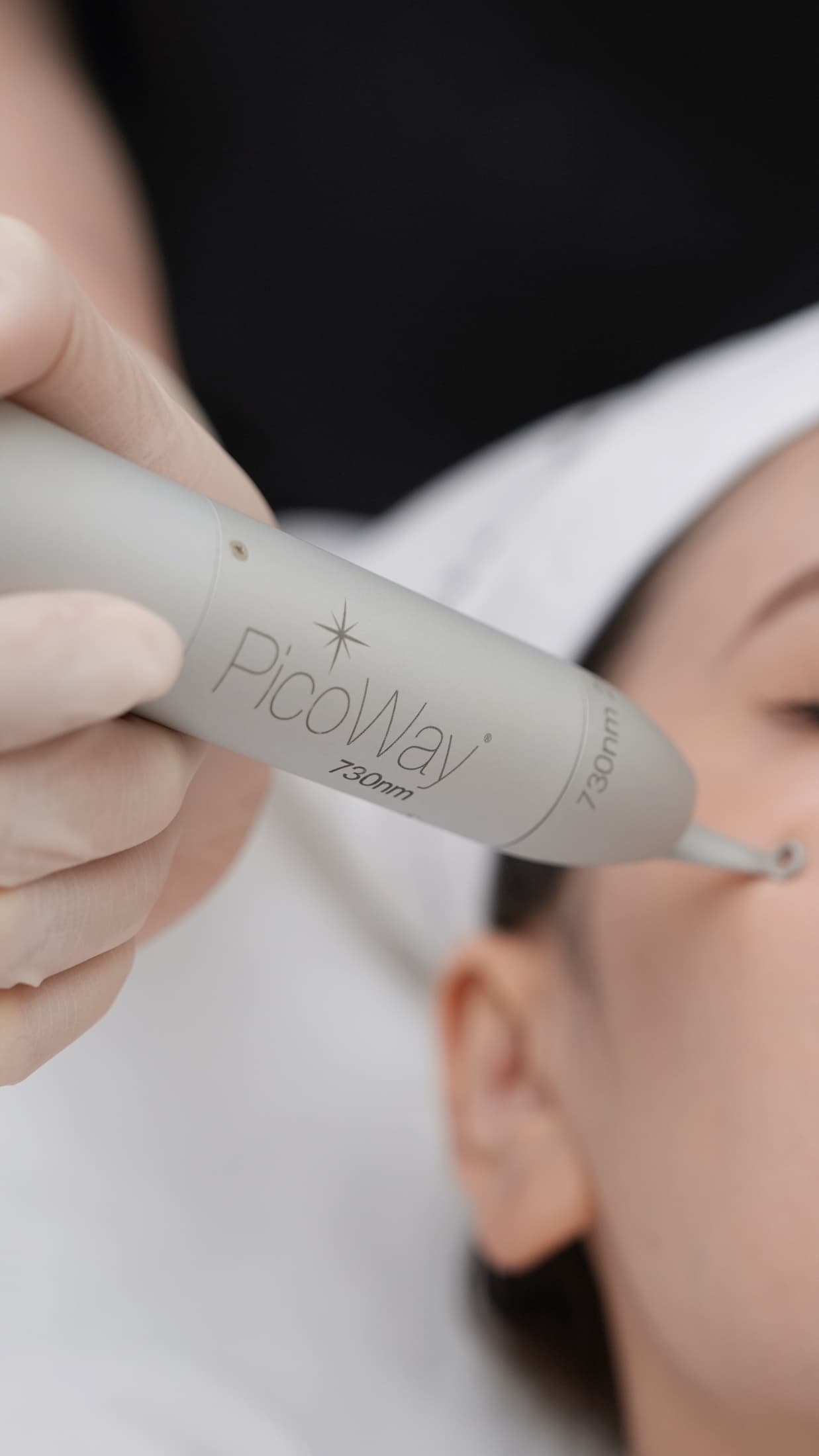 The PicoWay 730nm handpiece in clinical use