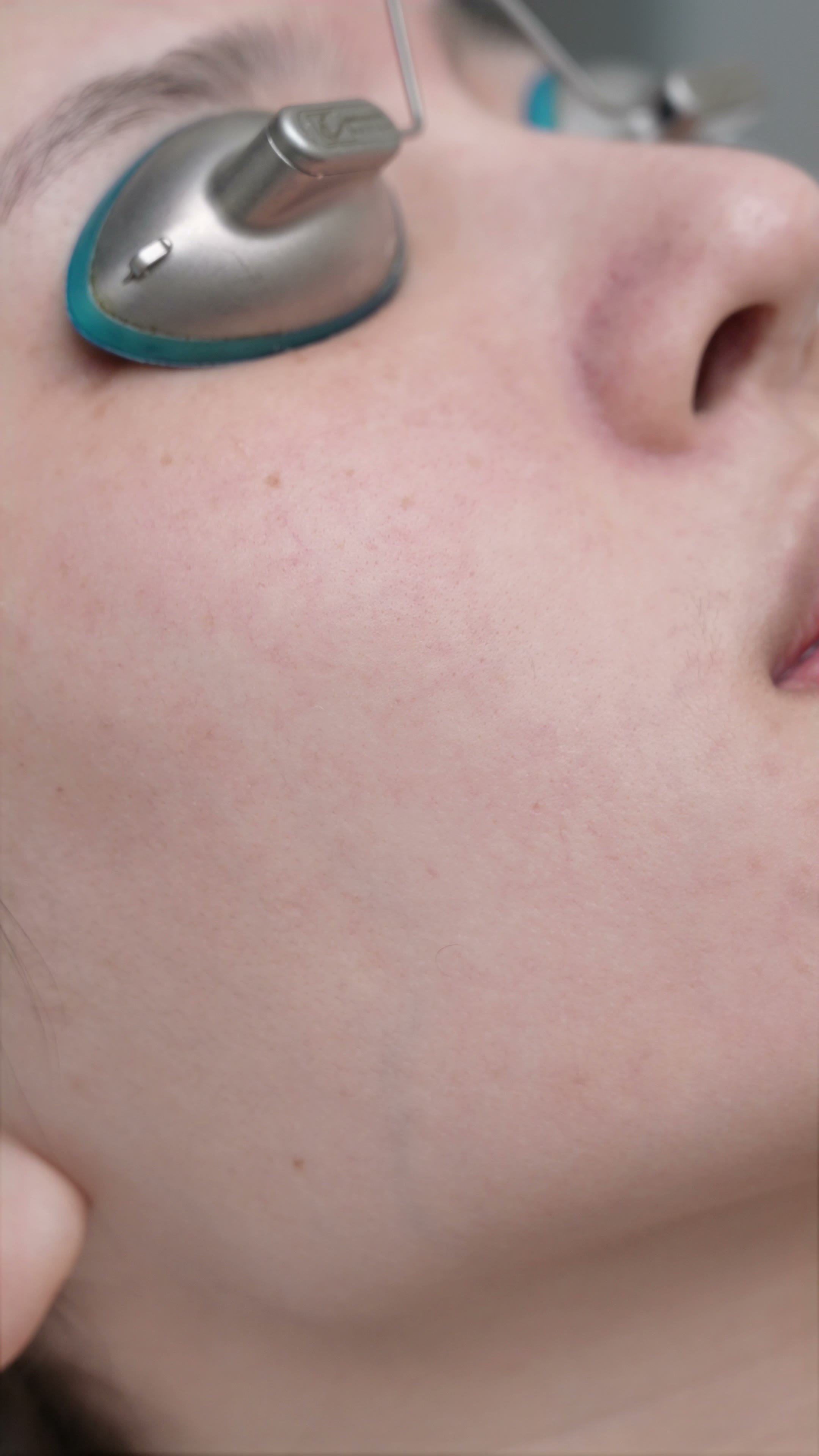 A vascular-targeted treatment moment